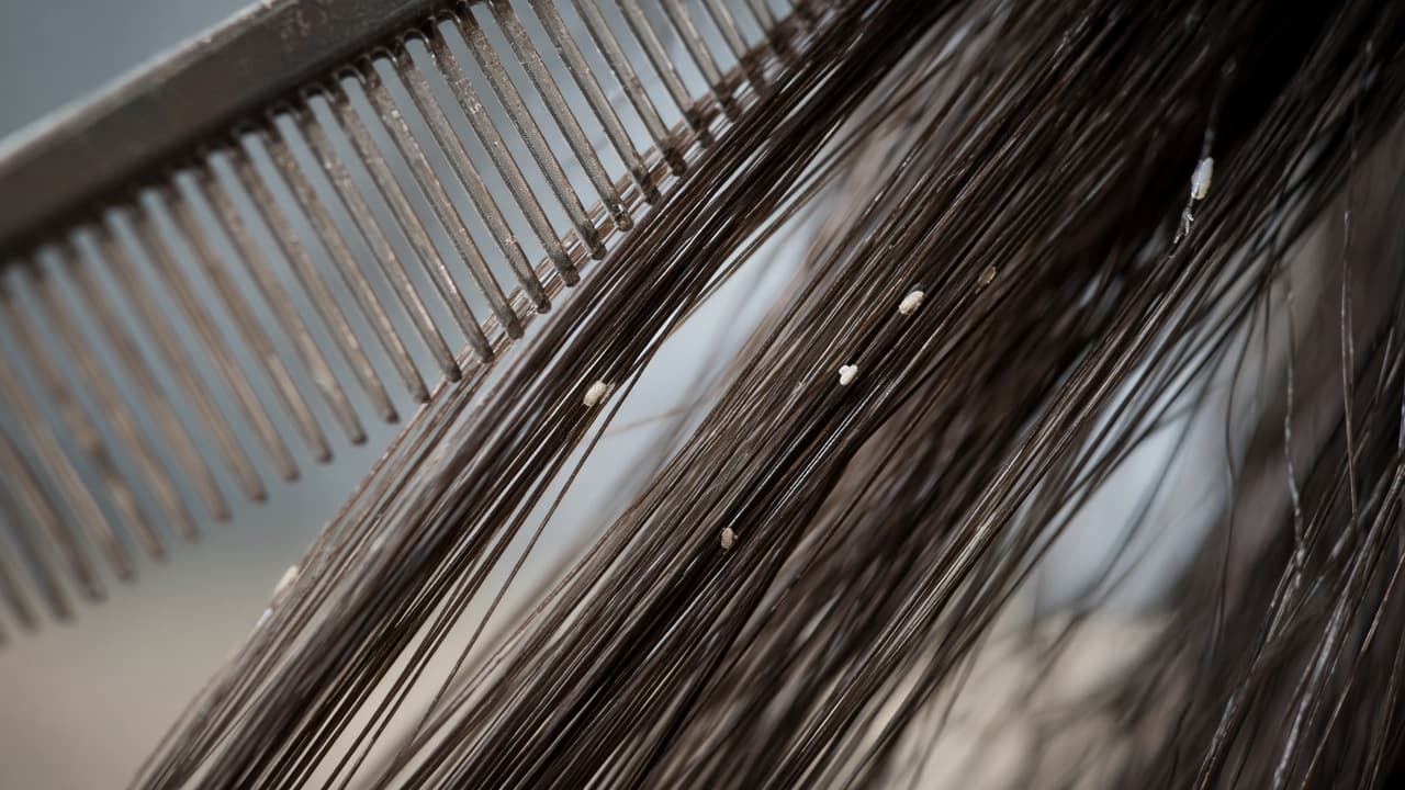 Tiny lice in hair close-up in a dream